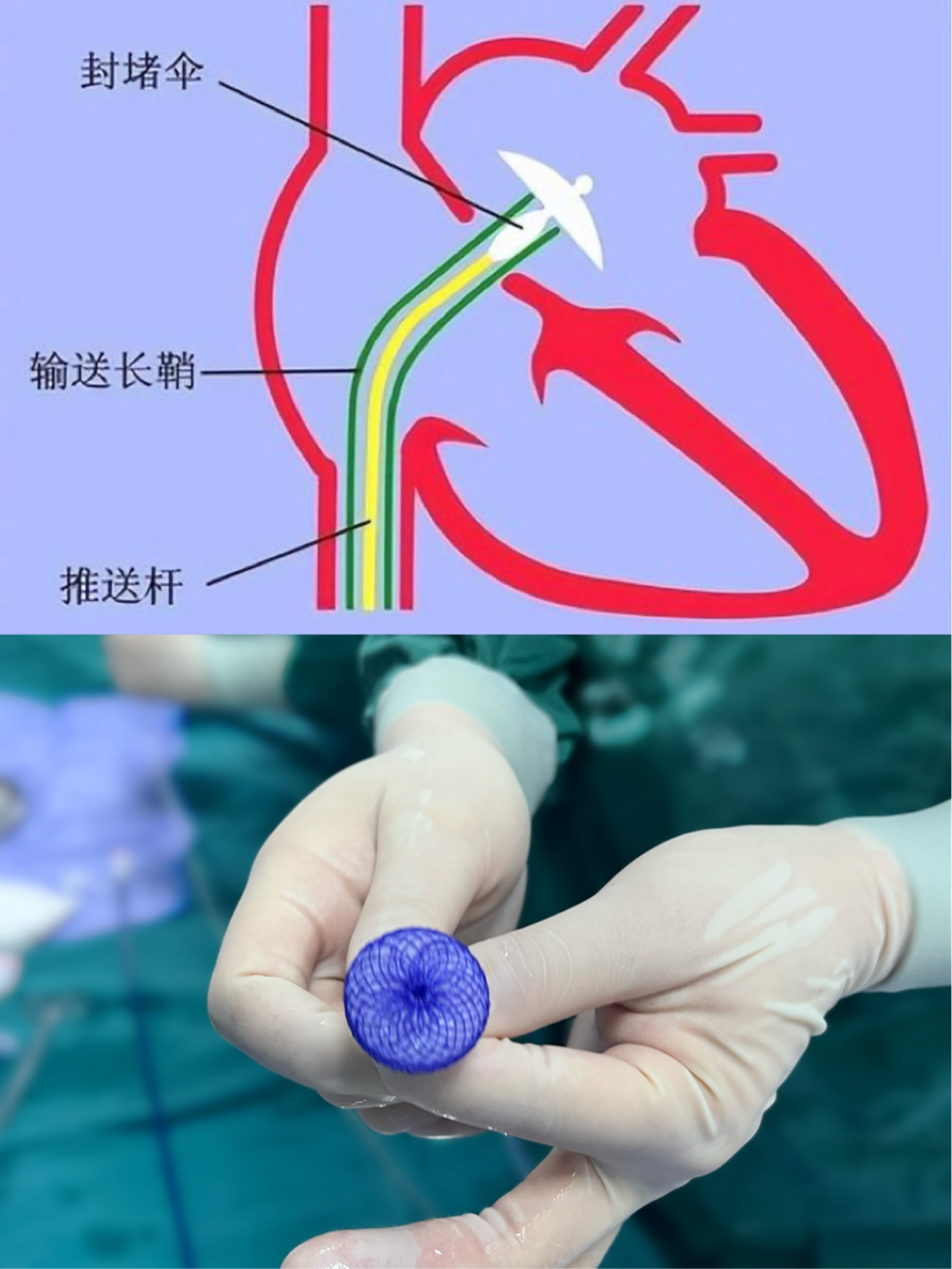 ca8631a13fe1975a55f9b7d44285cea4.png